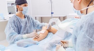 Cirurxía para varices